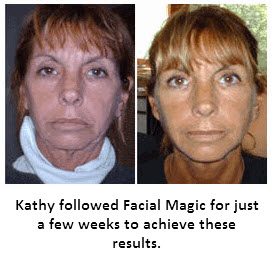 Facial Magic before and after