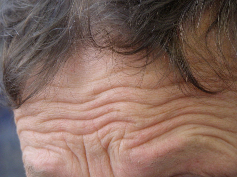 Forehead Wrinkles, Causes & How To Stop Them - Facial Exercise Central